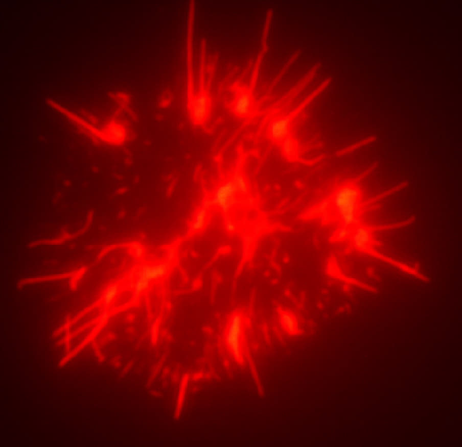 An unofficial gate to periodontal biomarkers